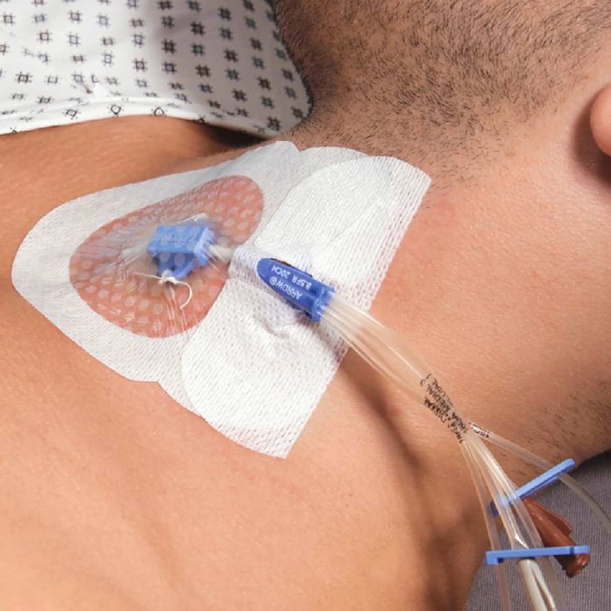 Curafix® i.v. Control Katheterfixierung