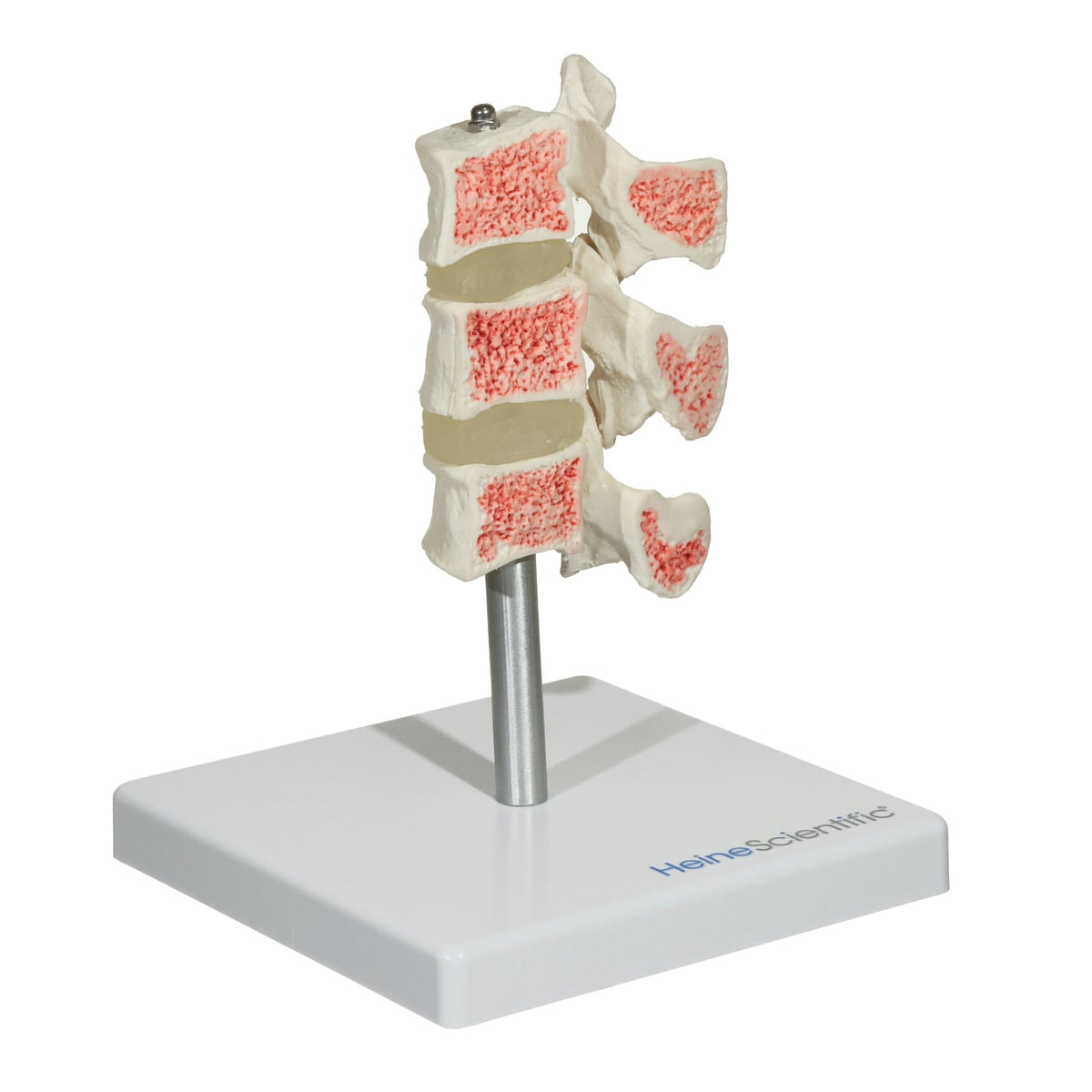 Osteoporose Modell