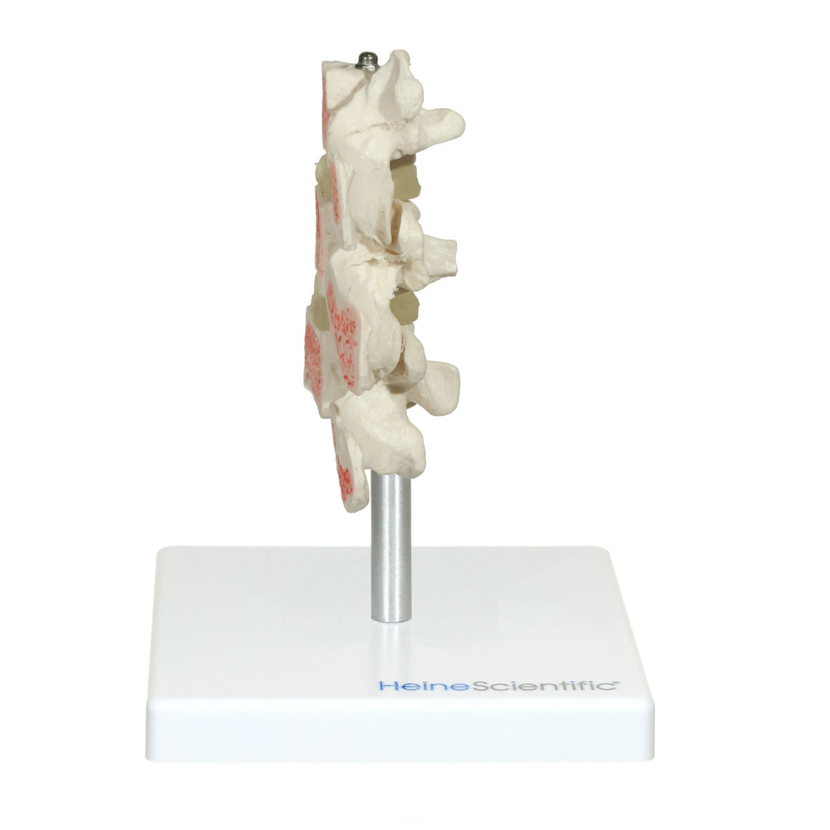 Osteoporose Modell