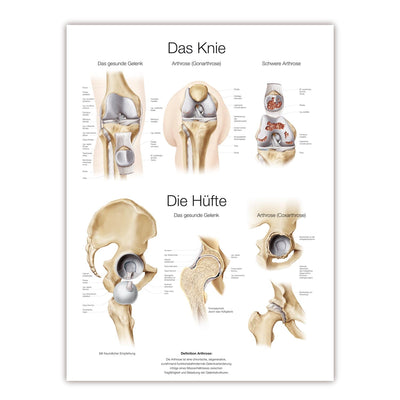 Lehrtafel Das Knie/ Die Hüfte