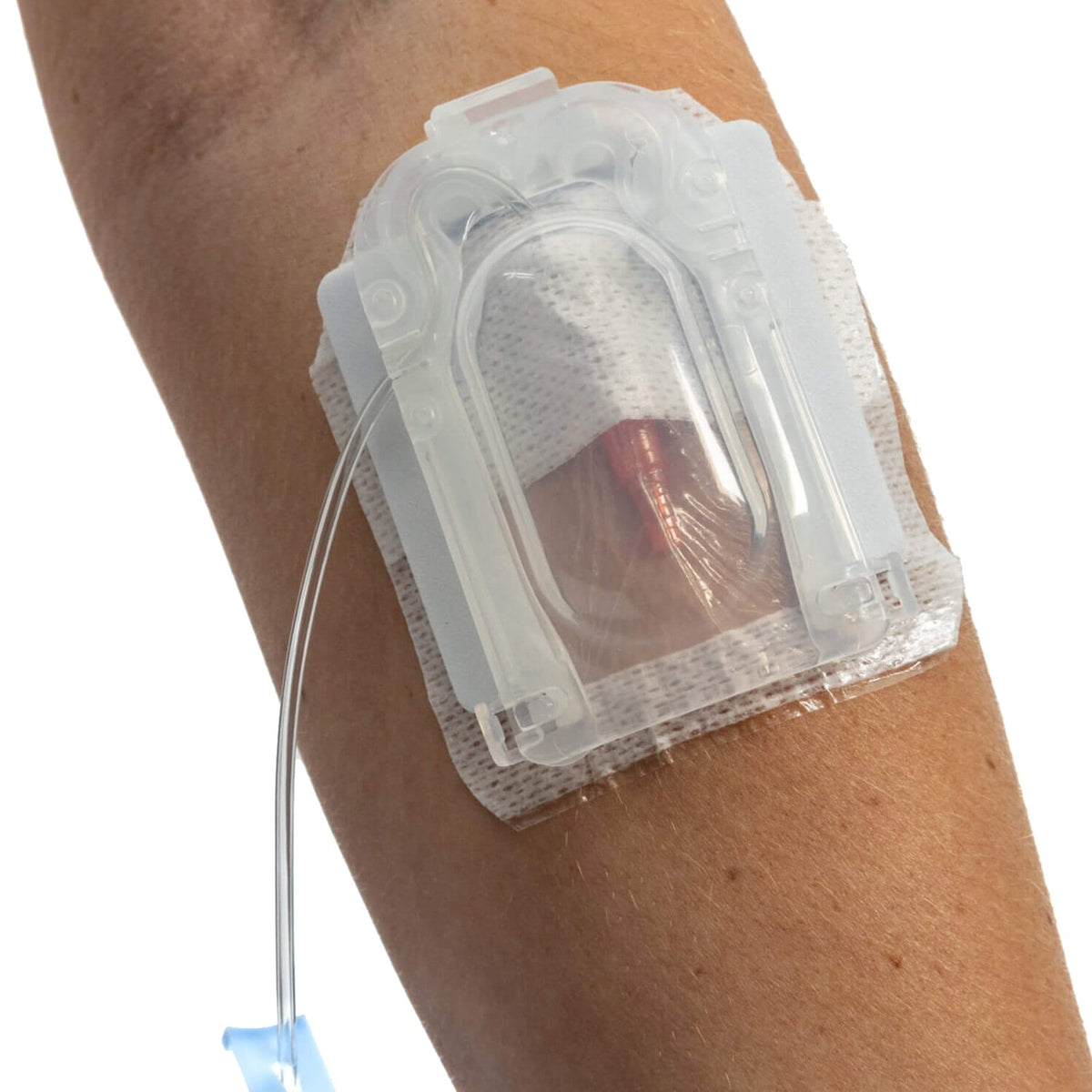 IV Glove Easystick