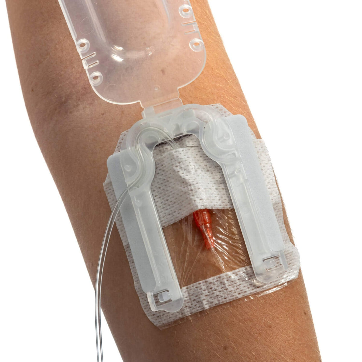 IV Glove Easystick