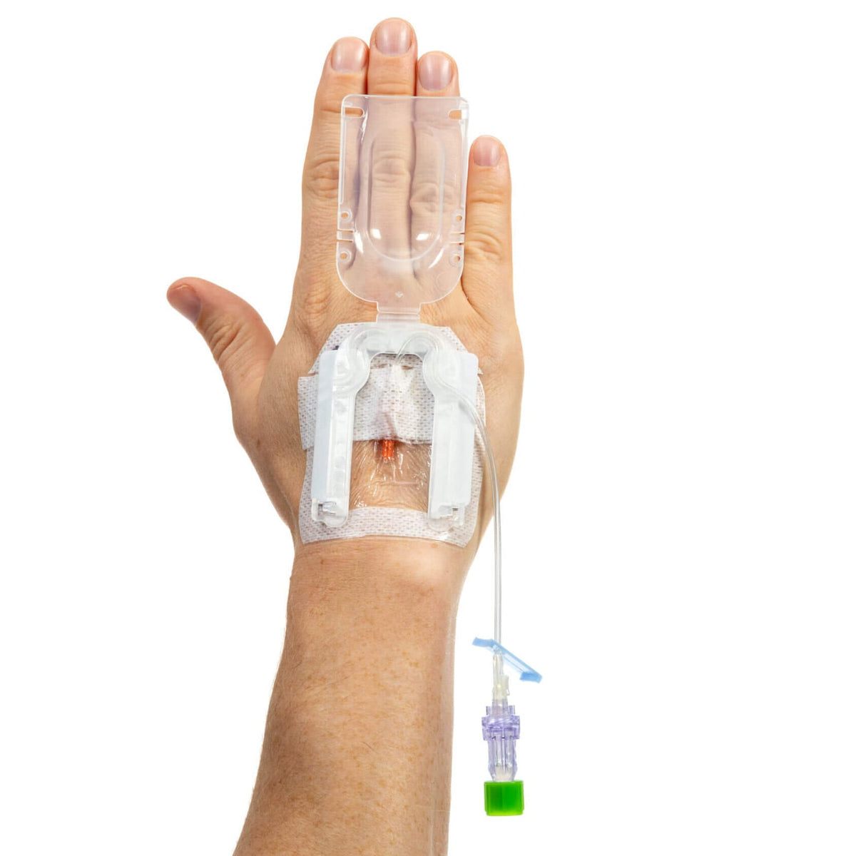 IV Glove Easystick