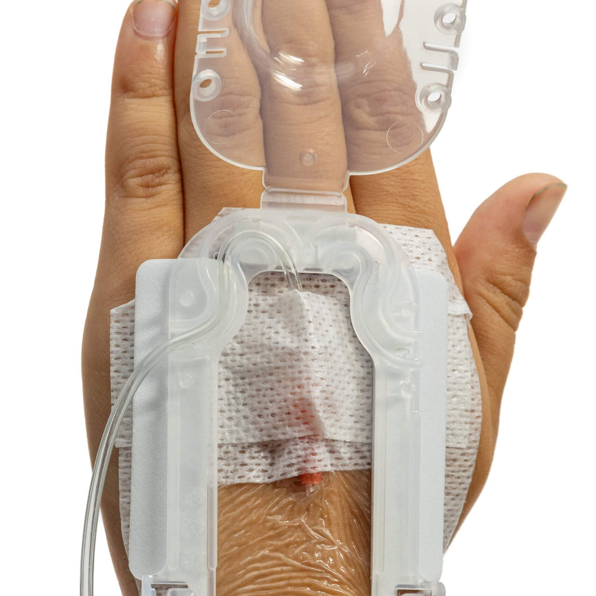 IV Glove Easystick