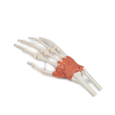 Bandapparat des Handgelenks