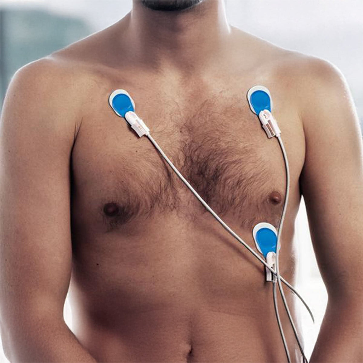 Ambu® BlueSensor