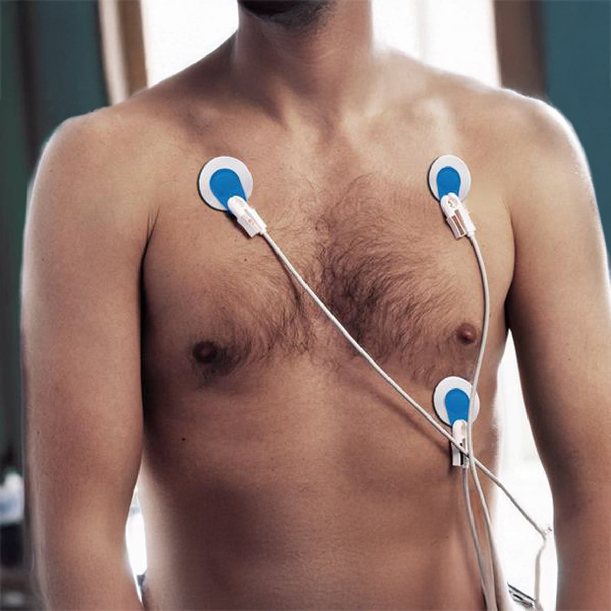 Ambu® BlueSensor