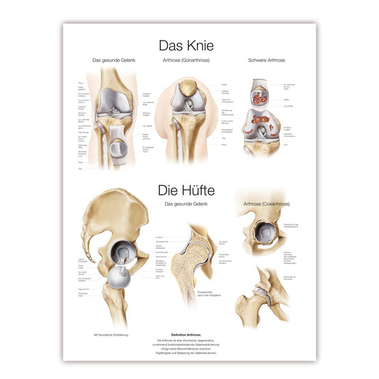 Lehrtafel Das Knie/ Die Hüfte