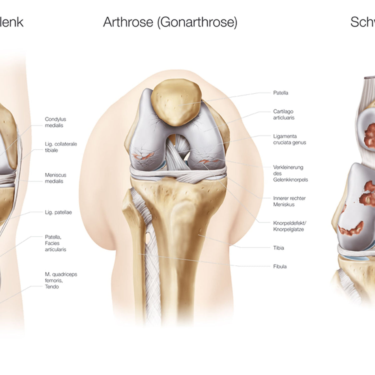 Lehrtafel Das Knie/ Die Hüfte