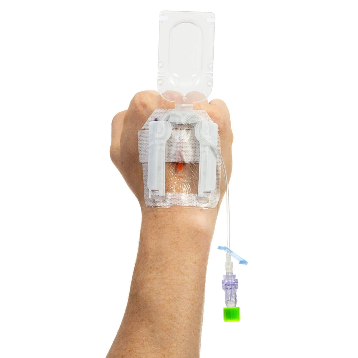 IV Glove Easystick