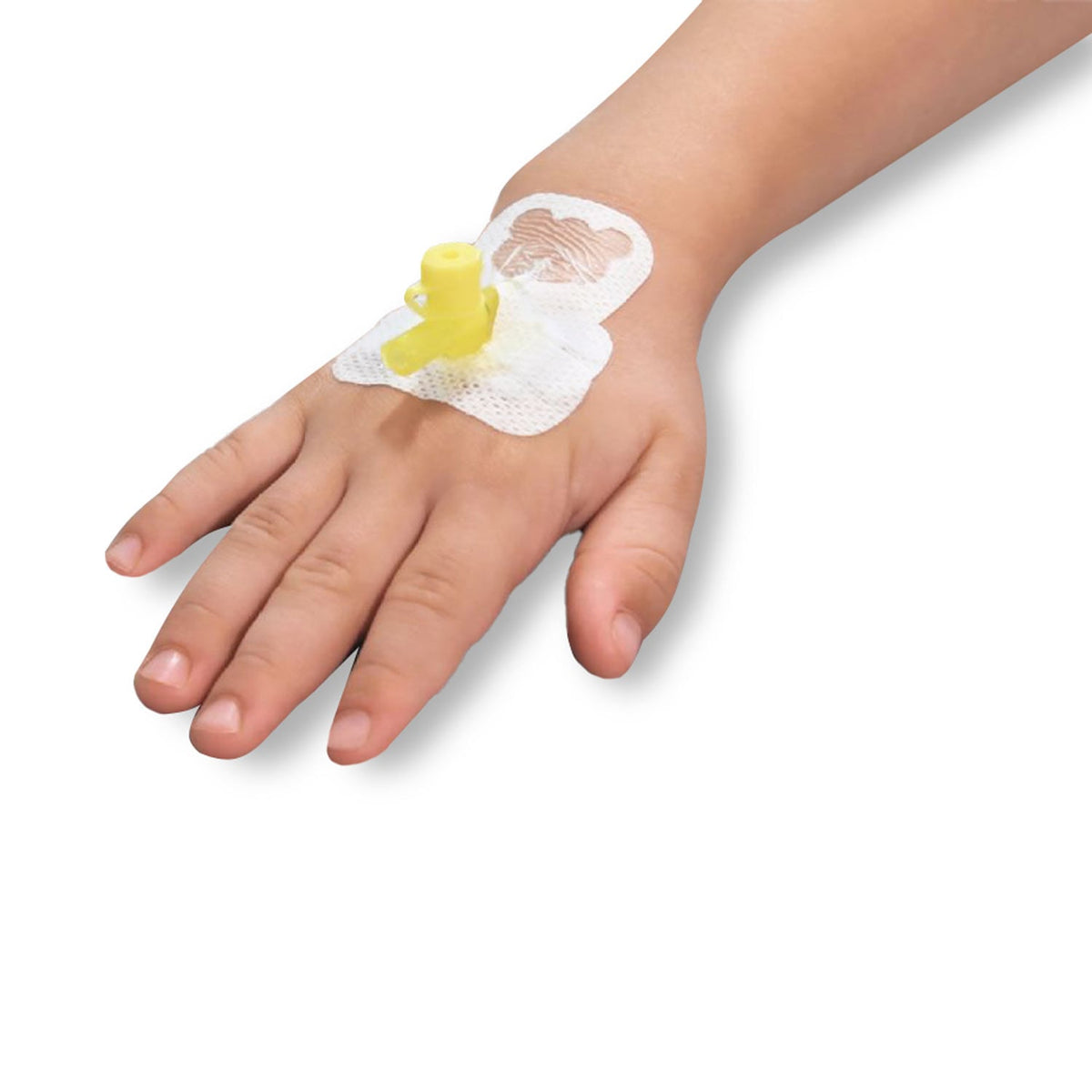 Curafix® i.v. Junior Kanülenfixierpflaster